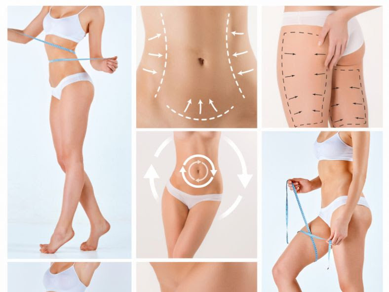 Lymphatic drainage, BBL aftercare, 360 Lipo, Body sculpting, body slimming, skin tightening, cellulite correction, body contouring, ideal image, laser lipo, post-op care, radio frequency cavitation, LED, Non-Surgical Facelift, cool sculpting 