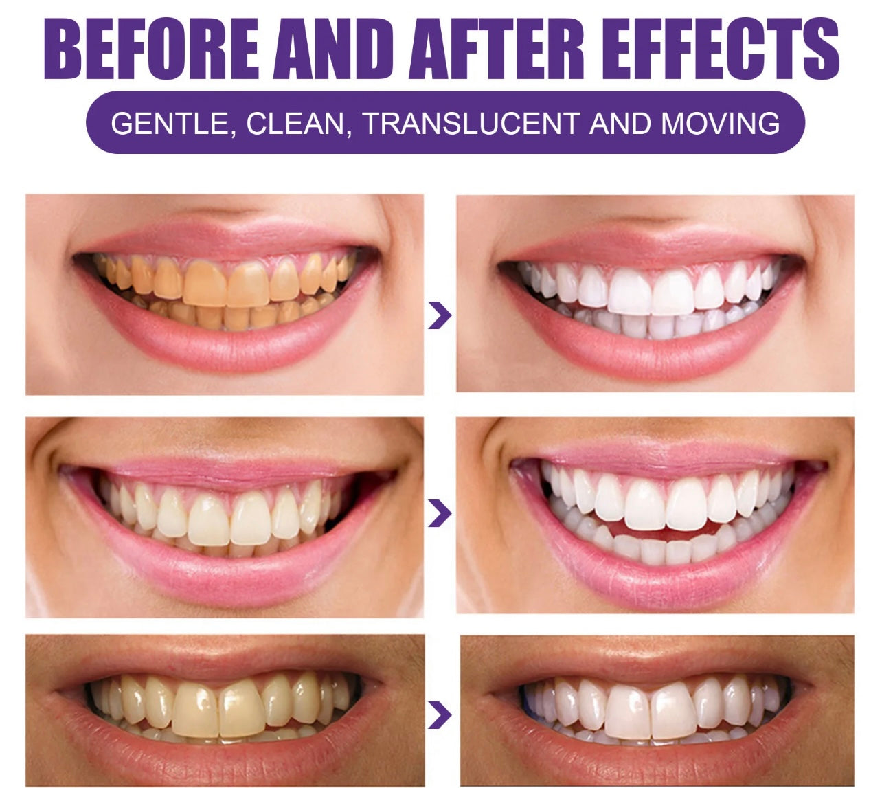 HiSmile Deep Purple Color Correcting Teeth Whitening. a fast, effective, and safe way to achieve a bright, healthy smile. stains, tooth discoloration TikTok viral products, TikTok made me by it. TikTok best items Whitening toothpaste, Whiten yellow teeth, whiten teeth naturally, whiten teeth from smoking, whiten teeth at home, TikTok viral, TikTok trends, TikTok made me buy it, tiktok best products,tik tok viral products, teeth whitening toothpaste, teeth whitening, teeth, stop tooth sensitivity