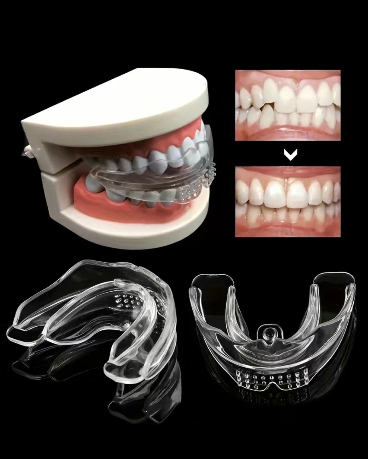 3 Stage Overnight Teeth Aligners - 3 Phase Night Guard Braces